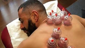 Terapi Bekam Profesional Sesuai Sunnah